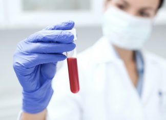 Czy borelioza jest problematyczna w postawieniu trafnej diagnozy?