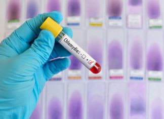 Teraz o Chlamydii…