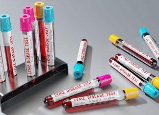 Dlaczego testy laboratoryjne zawodzą?