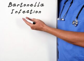 Współzakażenie Bartonella przy chorobie z Lyme – Co powinieneś wiedzieć? bartonella